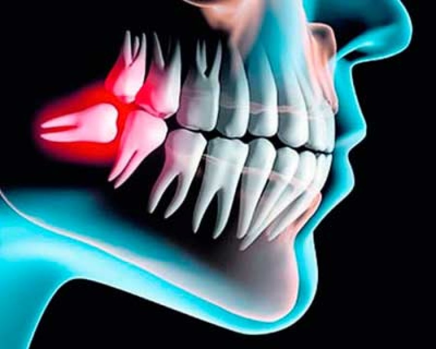 imatge de cirugia oral clínica dental madrid