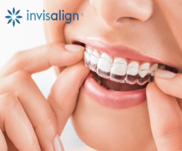 Invisalign Treatment Image Clinica Dental Madrid
