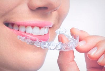 invisible orthodontic image madrid