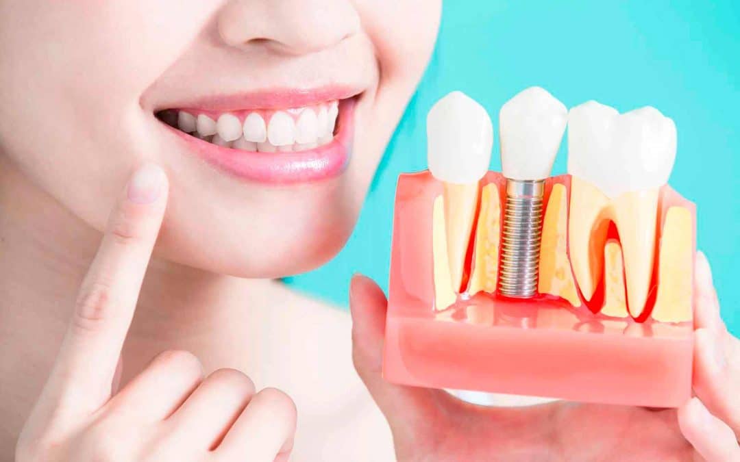 irudi endodontikoa tratamendu klinikoa mediku omid